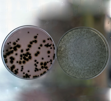 Two petri dishes