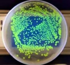 E. coli colonies in a petri dish