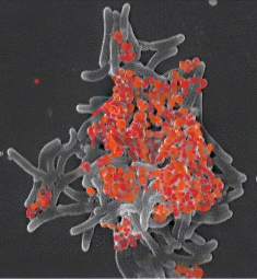 KM-Se particles
